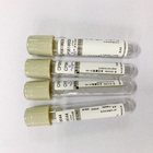 Accurate Ratio Glucose Blood Tube Grey Cap Sodium Fluoride EDTA 1:9