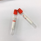 Disposable Plain Blood Collection Tube Red Cap  Serum Collection Tubes